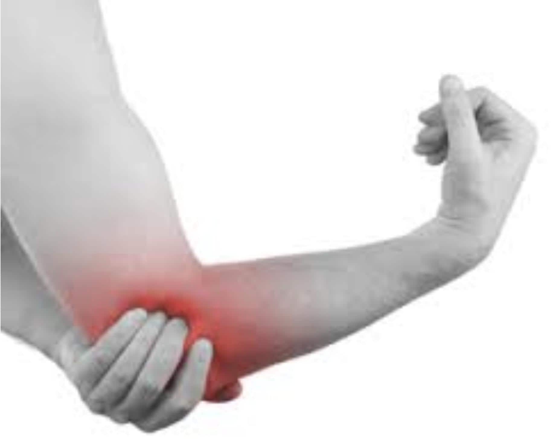 OLECRANON BURSITIS elbow pain